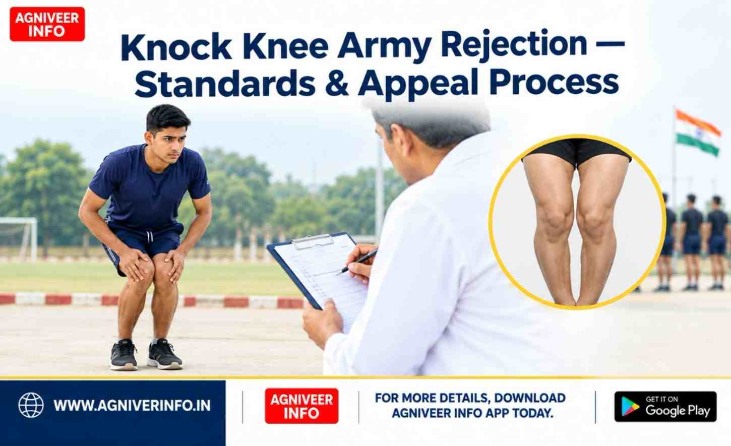 KNOCK KNEE ARMY REJECTION — ELIGIBILITY STANDARDS & APPEAL PROCESS